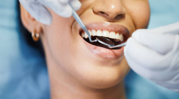 Best Emergency Dentist for Lost Fillings or Crowns in Florham Park, NJ