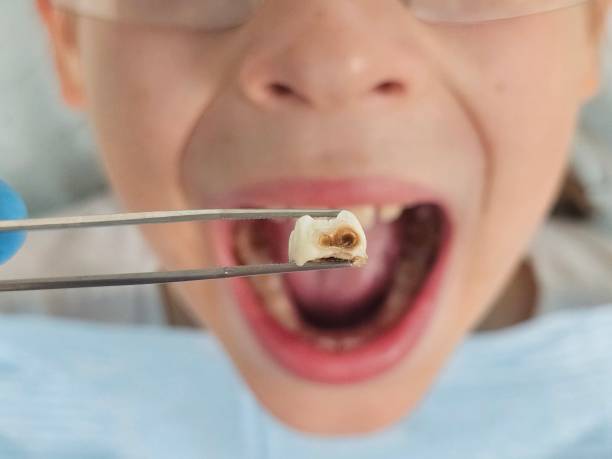 Best Emergency Dentist for Knocked-Out Tooth in Florham Park, NJ